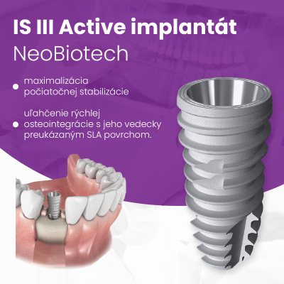 Minimalizujte stratu kostnej hmoty s implantátom IS III Active od spoločnosti NeoBiotech